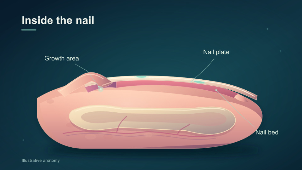 Overcoming Onychomycosis